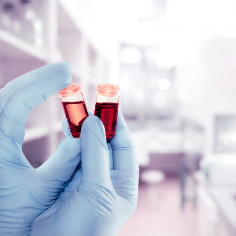 what-is-functional-lab-testing-768x767
